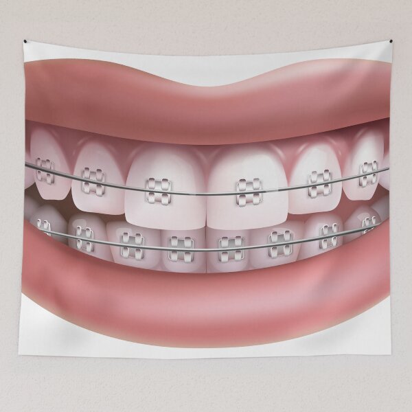 Item preview, orthodontic smile designed and sold by neteor.