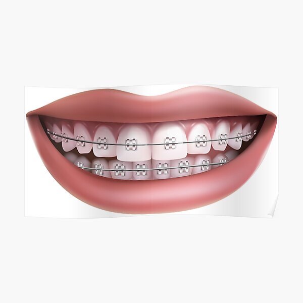 Orthodontic Posters Redbubble