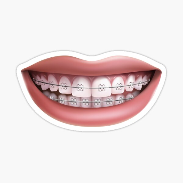 Orthodontic Stickers | Redbubble