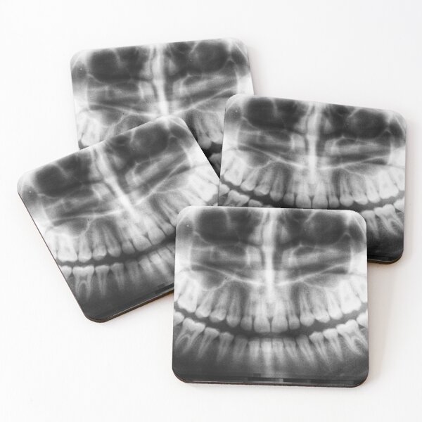 Item preview, Black and White Dental X-Ray Skeletal Print designed and sold by cgroenewald.