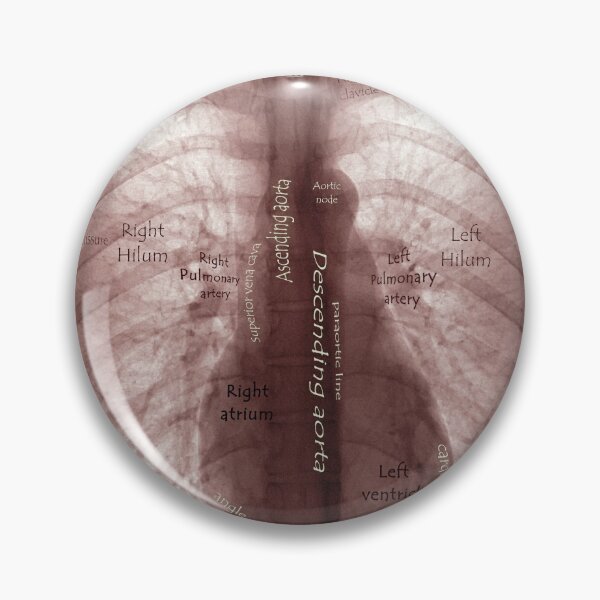 Item preview, X ray designed and sold by IschemicNeuron.