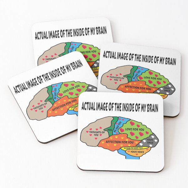 Item preview, ACTUAL IMAGE OF the INSIDE OF MY BRAIN designed and sold by ArrigoLazzaro.