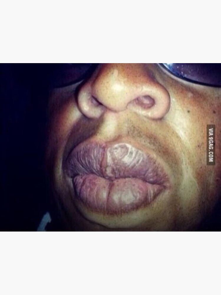 Which rapper got the sexiest lips.