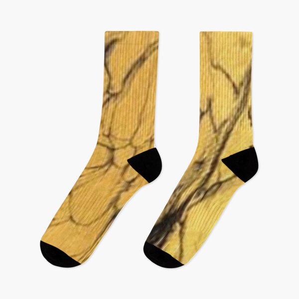Item preview, Yellow black crackle designed and sold by Hvll1116.