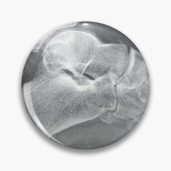 Artikelvorschau, Boneshmasher - x-ray entworfen und verkauft von picturetom.