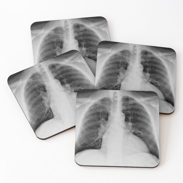Item preview, Boneshmasher - chest x-ray designed and sold by picturetom.