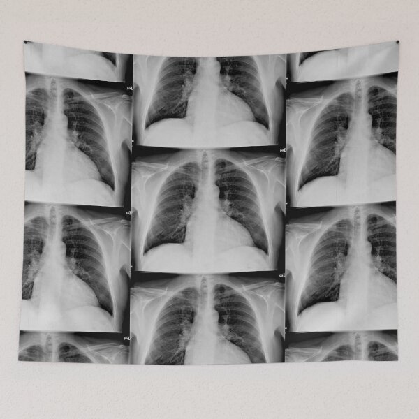 Item preview, Boneshmasher - chest x-ray designed and sold by picturetom.