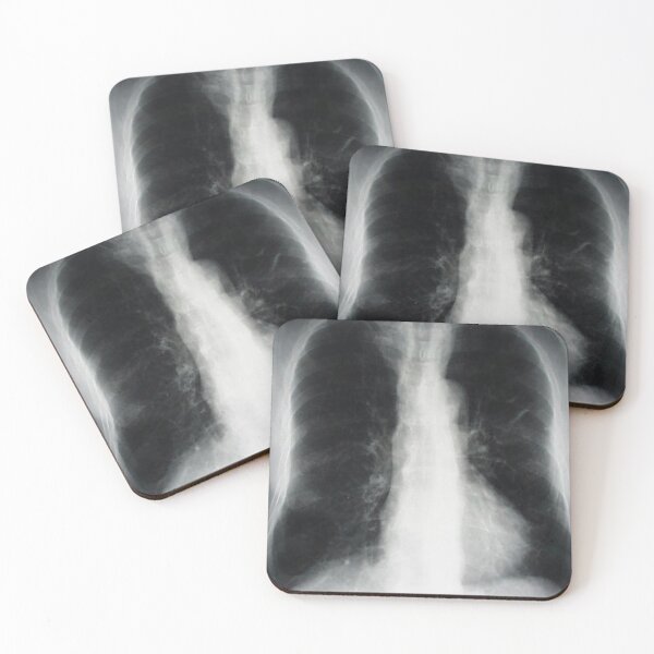 Item preview, lung designed and sold by picturetom.