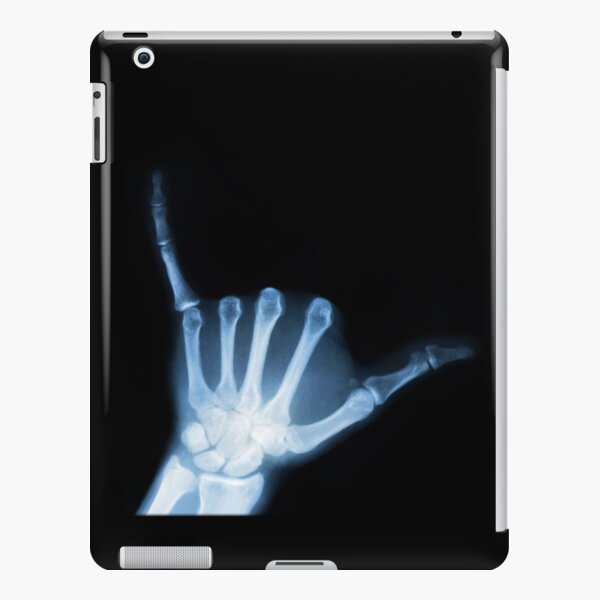 Xray Hand Ipad Cases Skins Redbubble - xray roblox