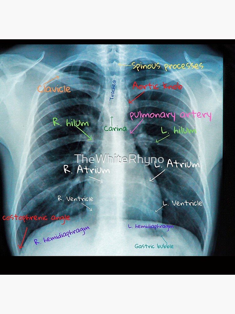 Female chest and abdomen muslces, pink x-ray view. Poster Print by