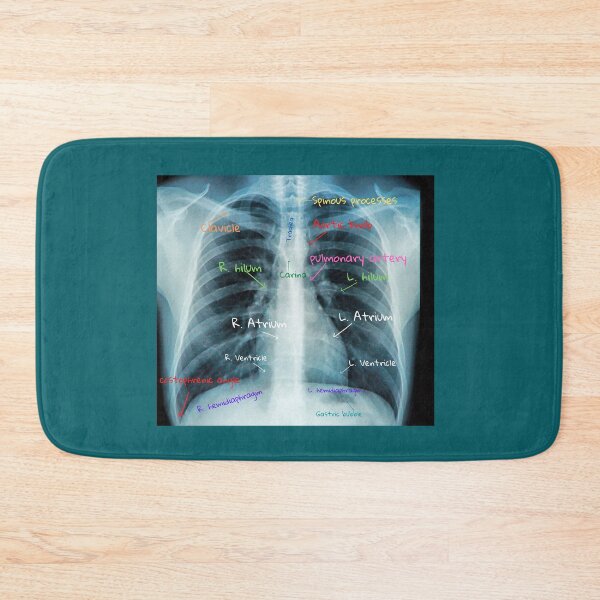 Item preview, Chest X-ray with labels designed and sold by TheWhiteRhyno.