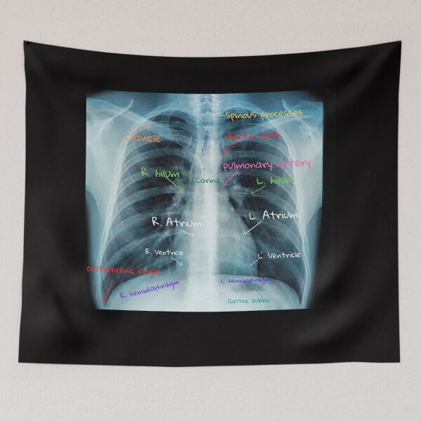 Item preview, Chest X-ray with labels designed and sold by TheWhiteRhyno.