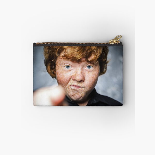 Item preview, Fat freckled boy portrait designed and sold by Alexander Sorokopud.