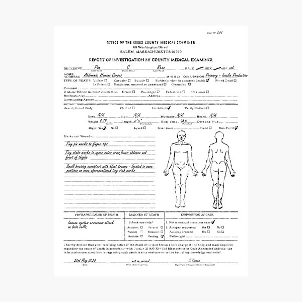 quot Autopsy of the Diabetic Pancreas quot Photographic Print for Sale by