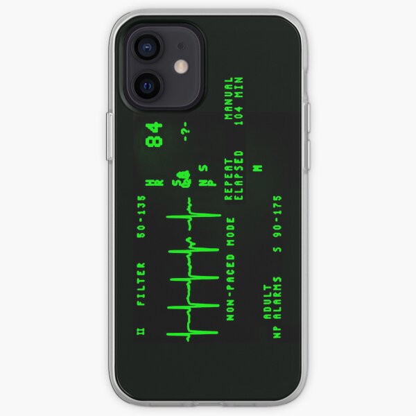 EKG Monitor iPhone Soft Case