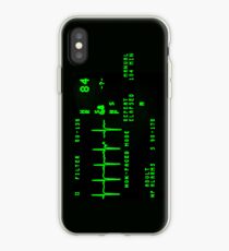 EKG Monitor iPhone Case
