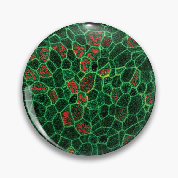 Item preview, Epithelial Lung Cells (jammed) designed and sold by SarinaMitchel.