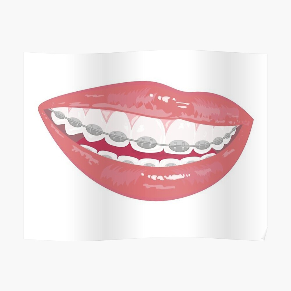 Braces Mask By Pipsta Redbubble - braces face roblox