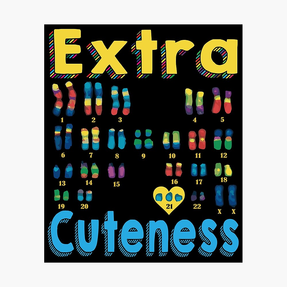 Extra cuteness XX Trisomy 21 World Down Syndrome\