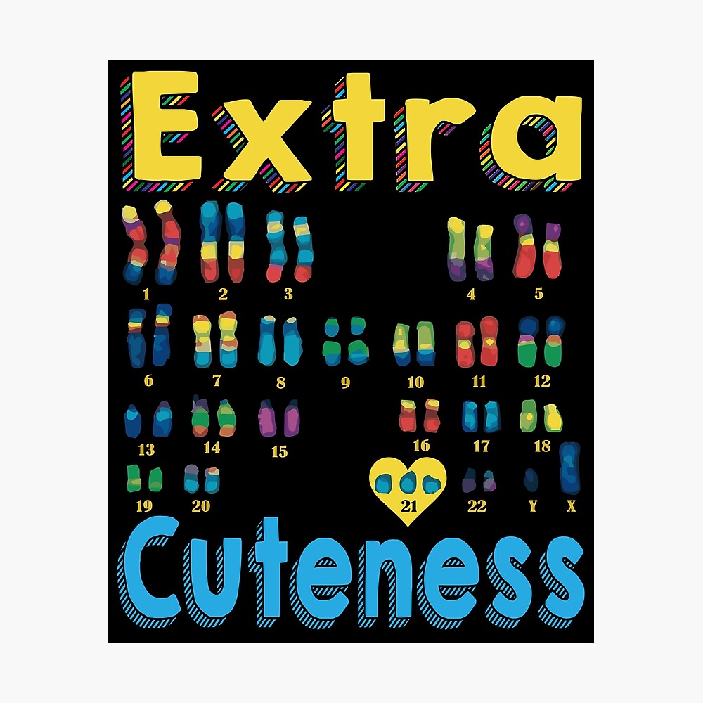 Extra cuteness XY Trisomy 21 World Down Syndrome\