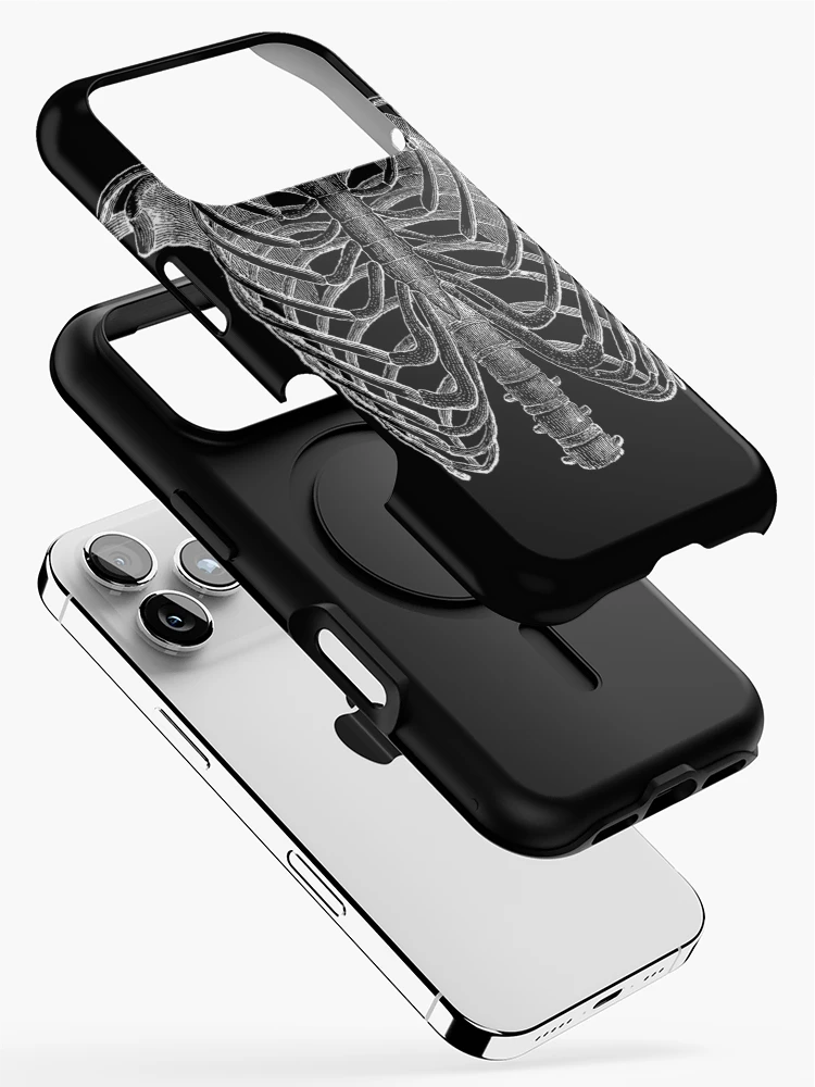 Aperçu 2 sur 4. Coque iPhone avec l'œuvre Cage Rib créée et vendue par sofich.