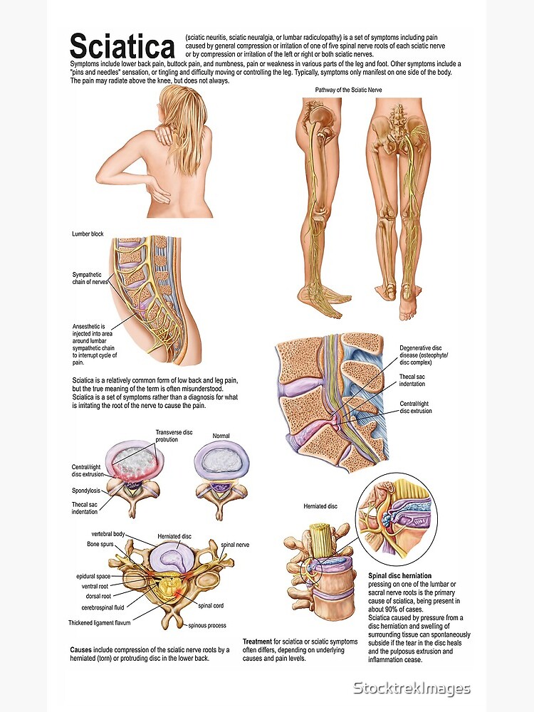 10+ Lower Back Nerves Diagram