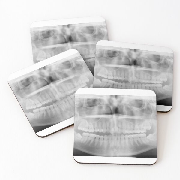 Item preview, X-ray vision designed and sold by snailmonger.