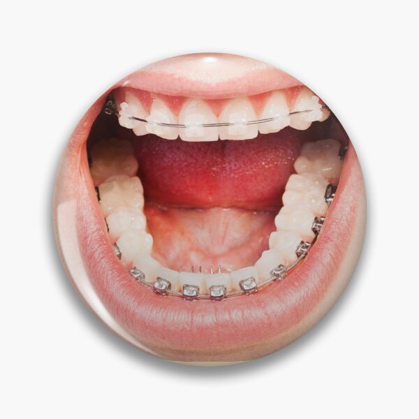 Item preview, Braces Shouting Mouth designed and sold by Deadstar1.