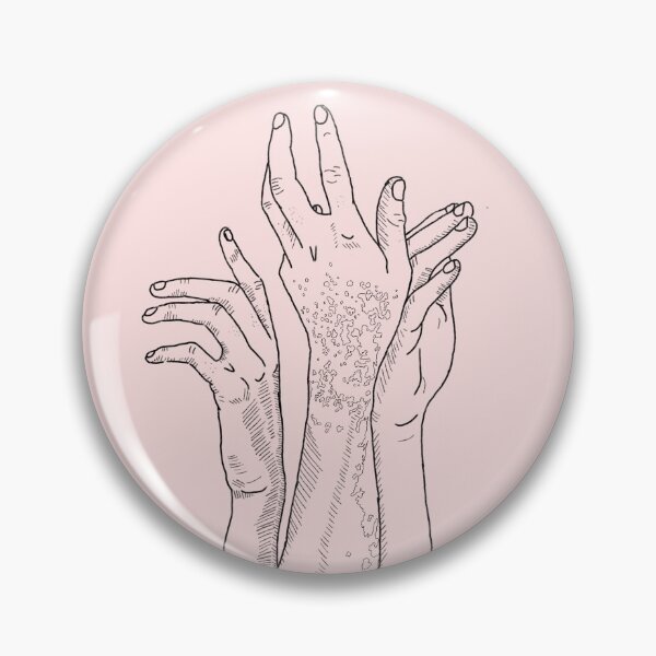 Item preview, The most beautiful skin condition designed and sold by ventumpluviam.