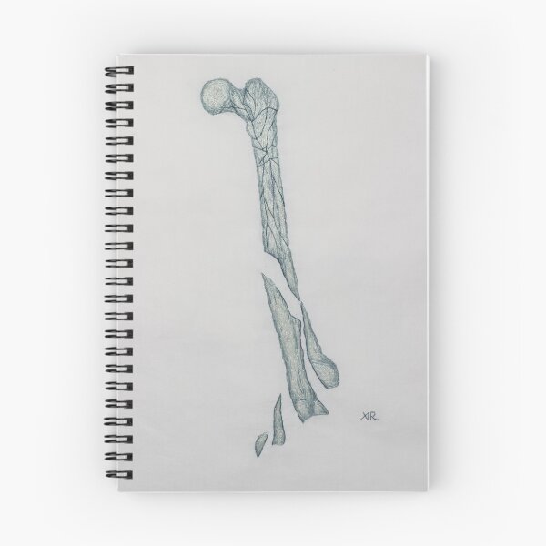 Item preview, Osteogenesis Imperfecta designed and sold by Aimee  Rondel.