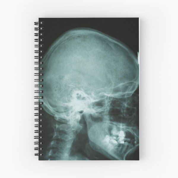 Item preview,  x-ray skull of human designed and sold by Claraveritas.