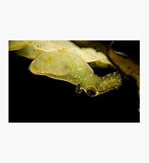 X-Ray Photographic Print
