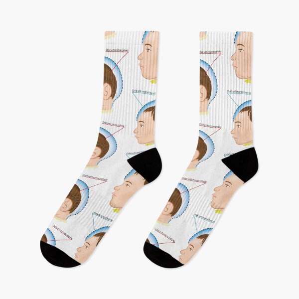Item preview, illustration of a newborn baby with microcephaly disease designed and sold by LucianoCosmo.