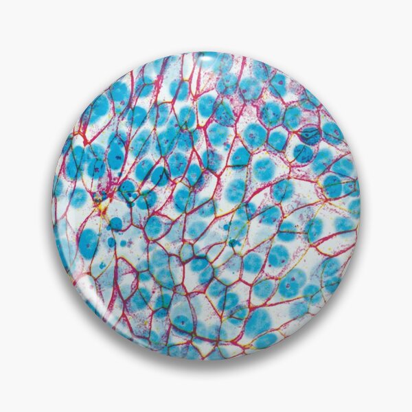 Item preview, Sky Balloons Design! (Epithelial Lung Cells, unjammed) designed and sold by SarinaMitchel.