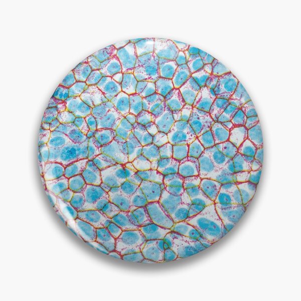 Item preview, Sky Balloons Design! (Epithelial Lung Cells, jammed) designed and sold by SarinaMitchel.