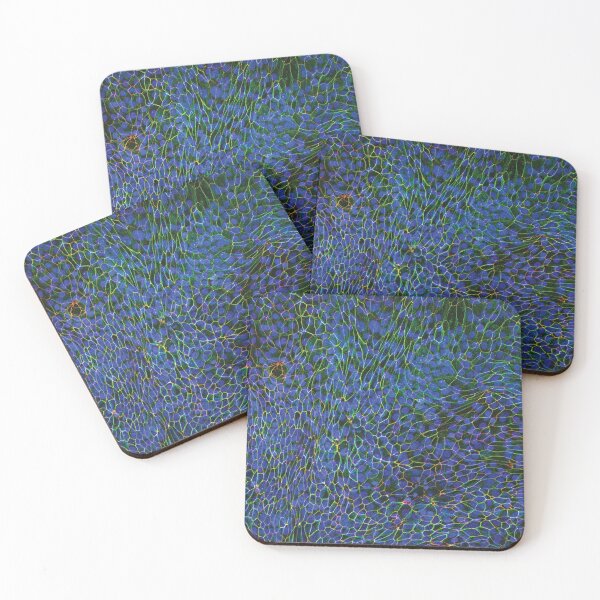Item preview, Epithelial Lung Cells, Blue (fluorescently labeled, unjammed) designed and sold by SarinaMitchel.