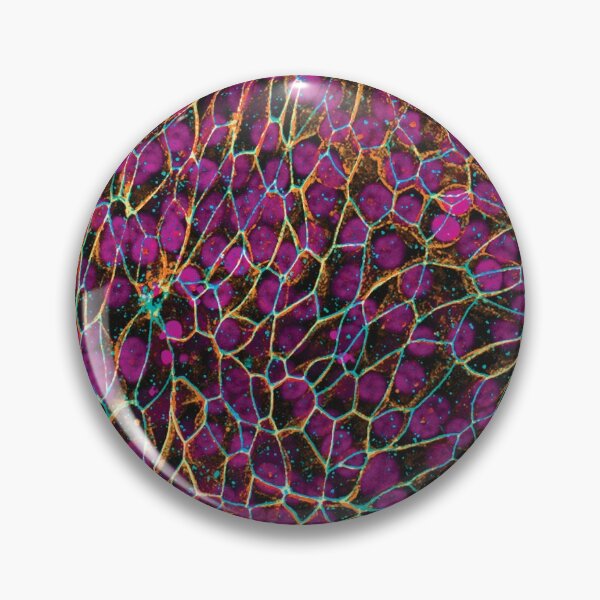 Item preview, Dragon Scales (Epithelial Lung Cells) designed and sold by SarinaMitchel.