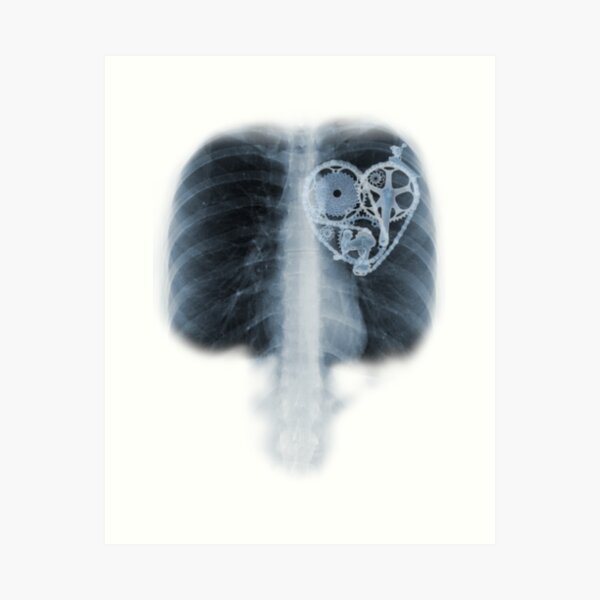 Item preview, BiKE LOVE X Ray bicycle heart components designed and sold by SFDesignstudio.