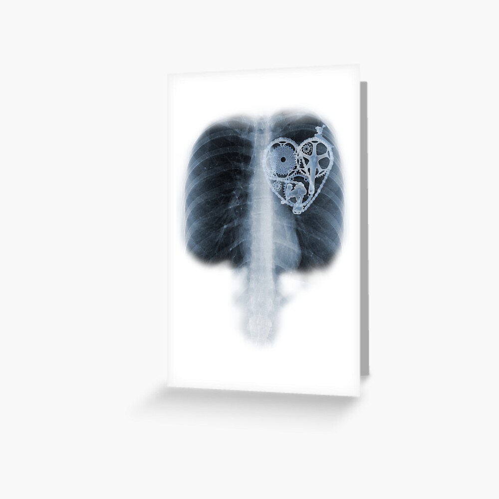 BiKE LOVE X Ray bicycle heart components Greeting Card