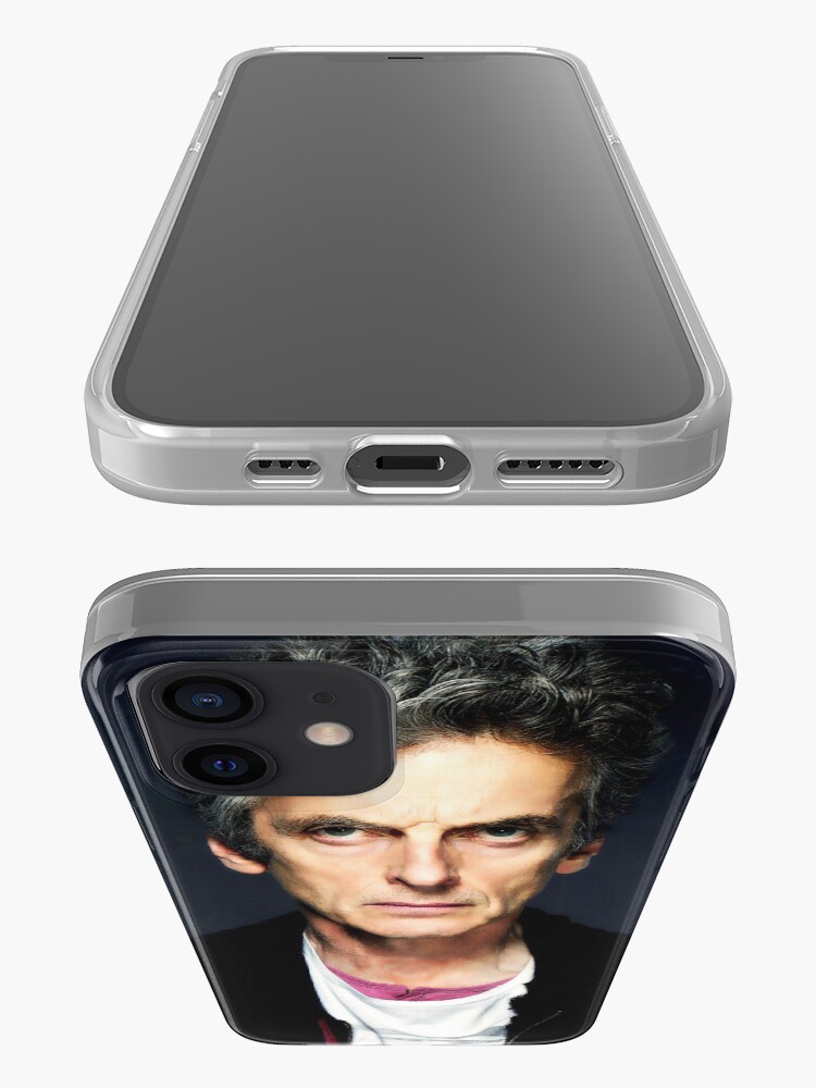 Alternate view of It's the Eyebrows iPhone Case & Cover