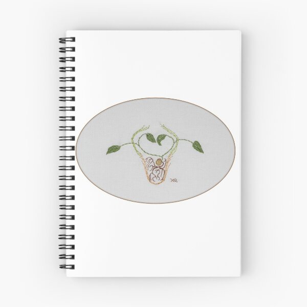 Item preview, Implantation designed and sold by Aimee  Rondel.