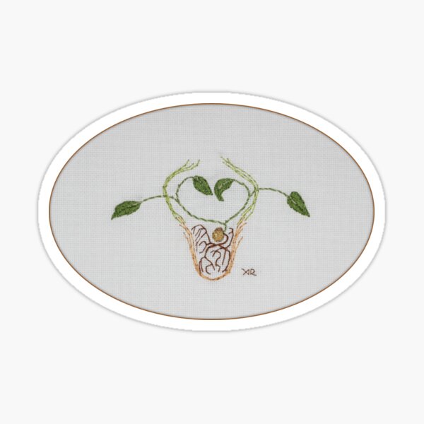 Item preview, Implantation designed and sold by Aimee  Rondel.
