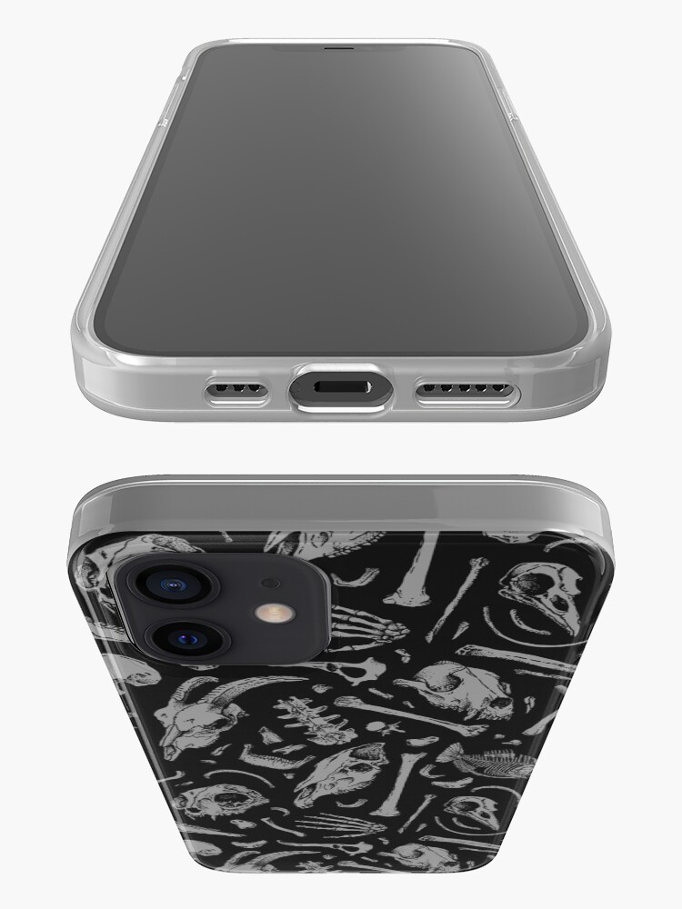 Alternate view of Bones iPhone Case & Cover