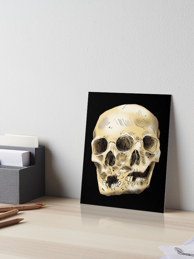 Double skull of Siamese twins