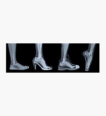Lámina fotográfica Radiografía del pie de una mujer en 4 zapatos diferentes