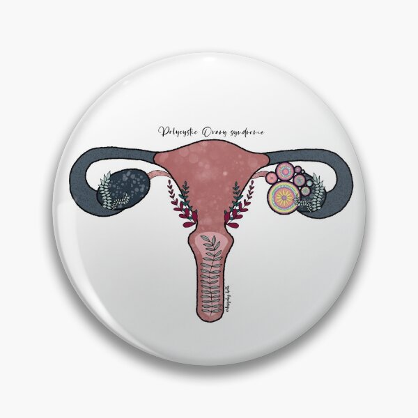 Item preview, Polycystic ovary syndrome (PCOS) designed and sold by Bethan Morgan.