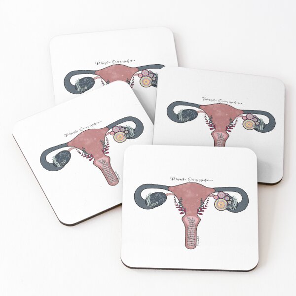 Item preview, Polycystic ovary syndrome (PCOS) designed and sold by Bethan Morgan.