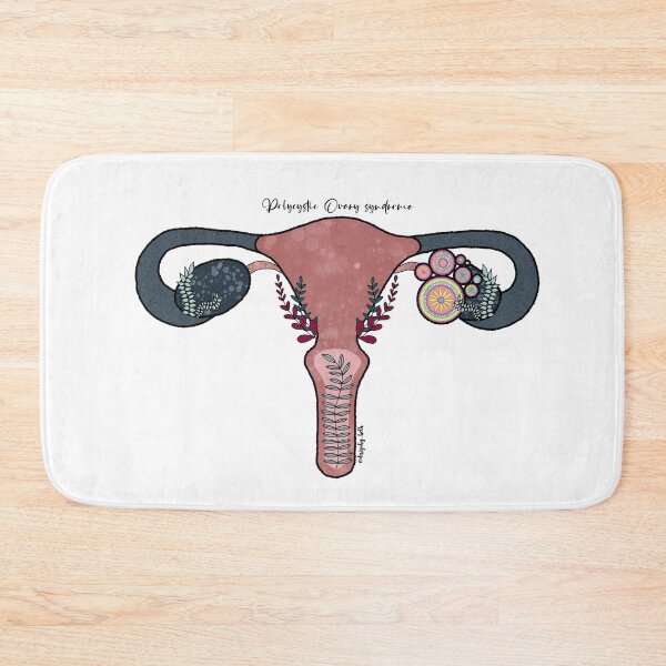 Item preview, Polycystic ovary syndrome (PCOS) designed and sold by Bethan Morgan.