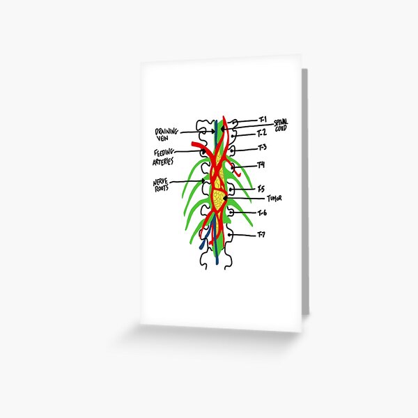 tumeur d'anatomie de gris Carte de vœux