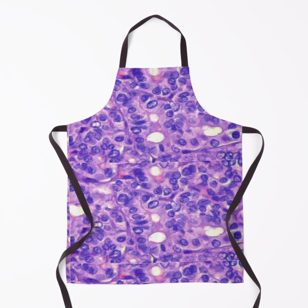 Item preview, Papillary carcinoma designed and sold by DarkiraVClemm.